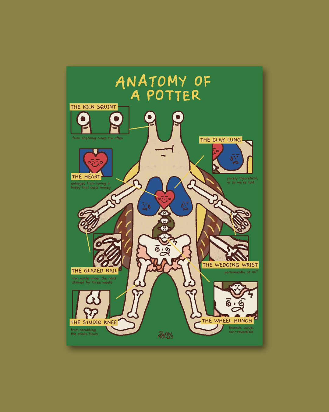 Anatomy of A Potter Print